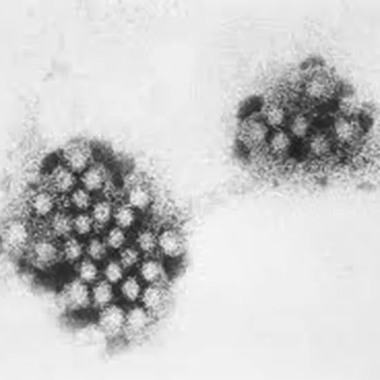 Calciviridae : A Tiny Virus With A Big Impact On Global Health